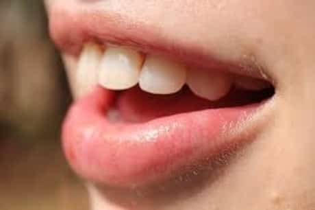 Bacterial Infection in Mouth