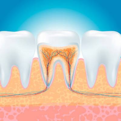 Average Cost of Root Canal Treatment in US