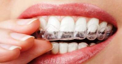 Bruxism - How to Stop Nighttime Teeth Grinding