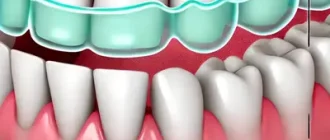 Why Do We Clench Our Teeth?