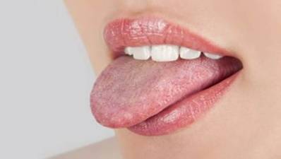 Dry Mouth Symptoms, Causes and Treatment