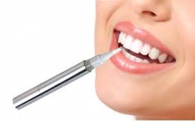 Effectiveness of Teeth Whitening Pen and How to Use It