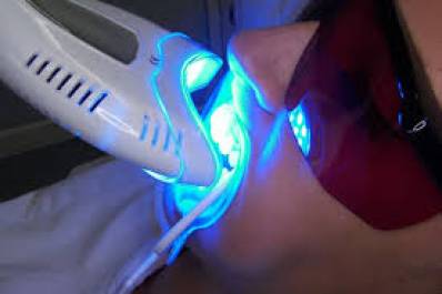 How Much Does It Cost to Get Teeth Laser Whitening
