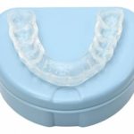 Night Guard Do You Need It for Teeth Clenching (Bruxism)