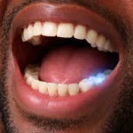 Close-up of an adult man’s open mouth showing mild blue glow on lower molars, illustrating tooth sensitivity and nerve response.