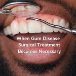 Close-up dental exam of a young bearded man showing inflamed gums during evaluation for gum disease surgery.