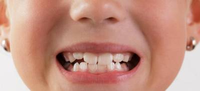 6 Year Molars Pain in Kids