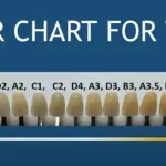color chart for teeth