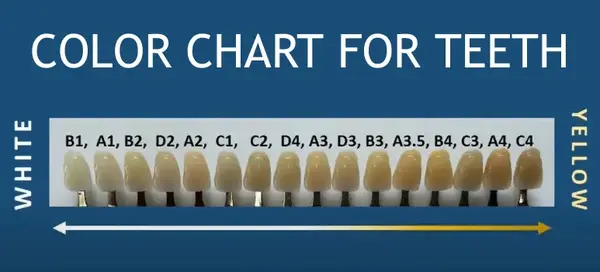 color chart for teeth
