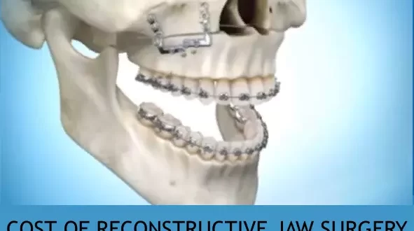 cost of reconstructive jaw surgery