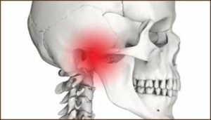 Jaw Clicking/Popping: Causes And Treatment | UtoDent.com