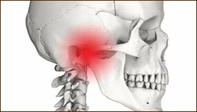 Causes of Jaw Clicking Jaw Popping Treatment