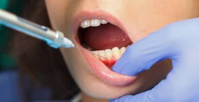 Dental Novocaine Side Effects