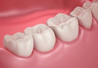 Gum Diseases, Periodontal Disease Stages