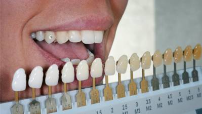 Denture Teeth Color Chart