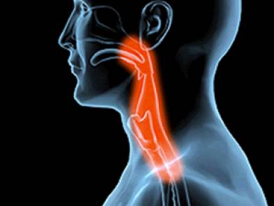 What Causes Difficulty Swallowing
