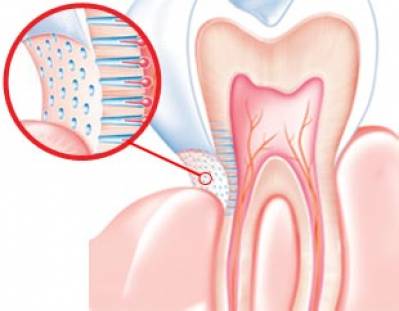 What Causes of Gum Sensitivity