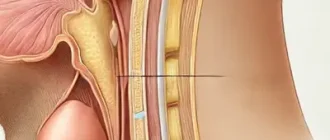 Parotid Gland Swelling