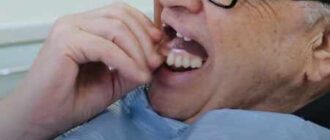 An old american man inserts a denture in his mouth