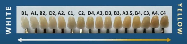 Teeth Shades Chart