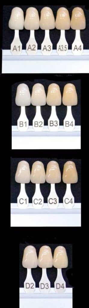 Teeth Color Chart And Natural Tooth Shade Oral Health 0637
