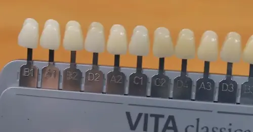 Vita scale tooth shades