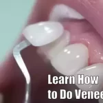 Learn How to Do Veneers: What Courses to Take and What Diploma You Need