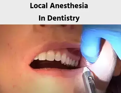 Local Anesthesia Techniques In Dentistry
