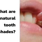 What are natural tooth shades?