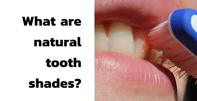 What are natural tooth shades?