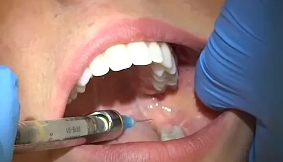 fainting after injection at dentist