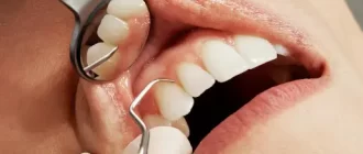 Lump on the Gum but No Pain